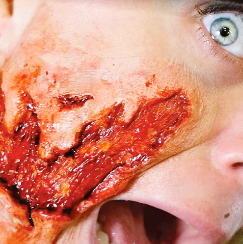 tinsley fx ripped flesh effect